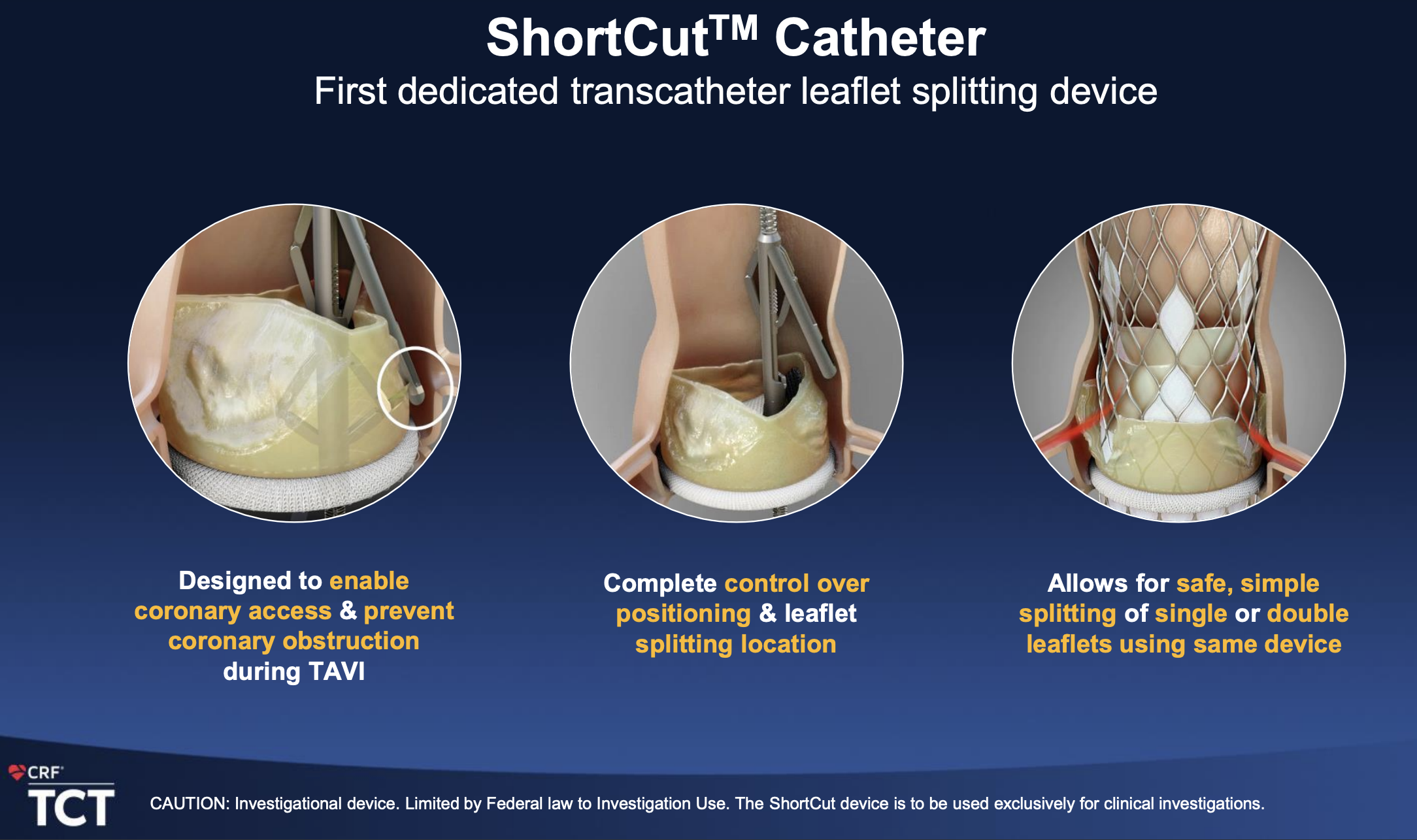 The ShortCut Pivotal Trial A Dedicated Valve Leaflet Splitting Device
